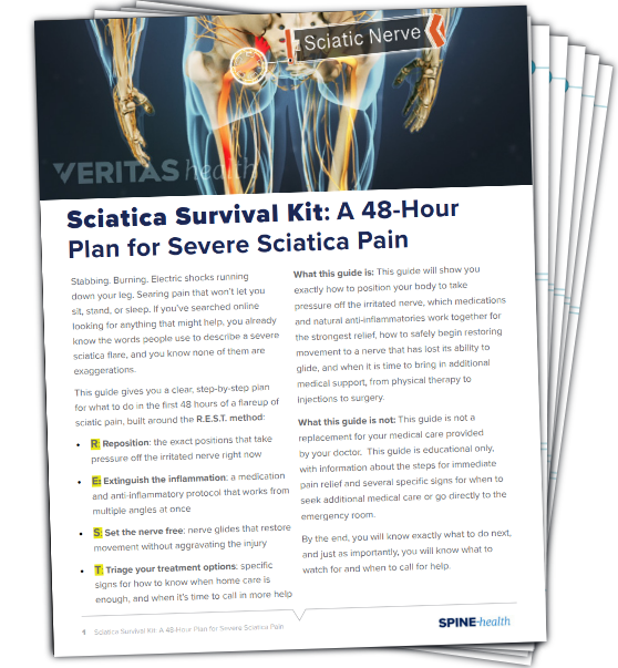 Sciatica Survival Kit: A 48-Hour Plan for Severe Sciatica Pain