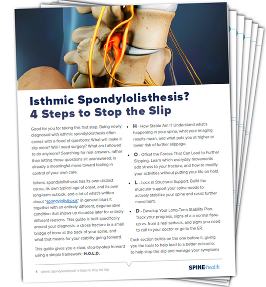Isthmic Spondylolisthesis: 4-Steps to Stop the Slip