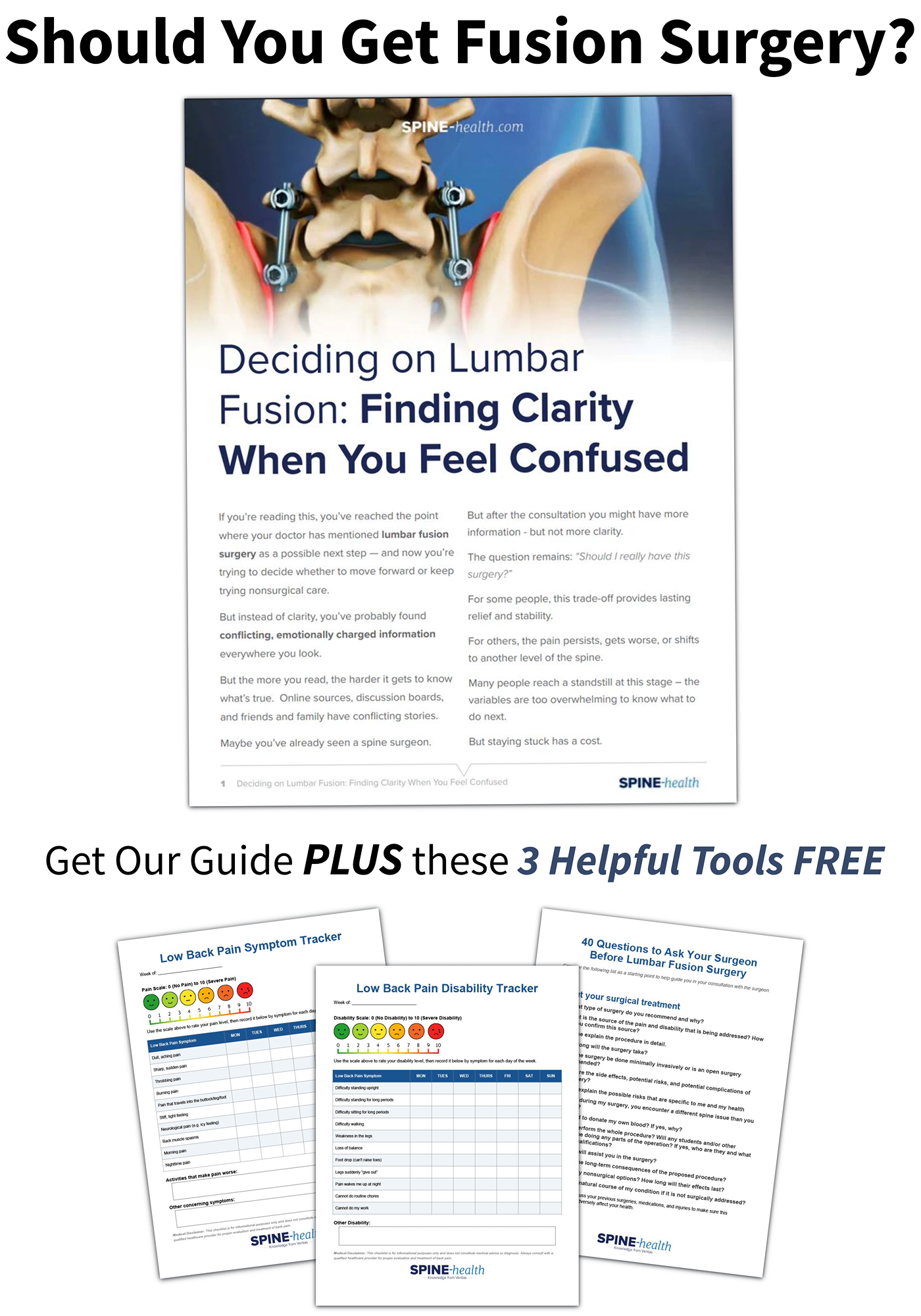 Deciding on Spinal Fusion Guide
