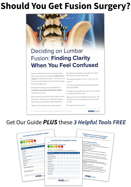 Deciding on Spinal Fusion Guide