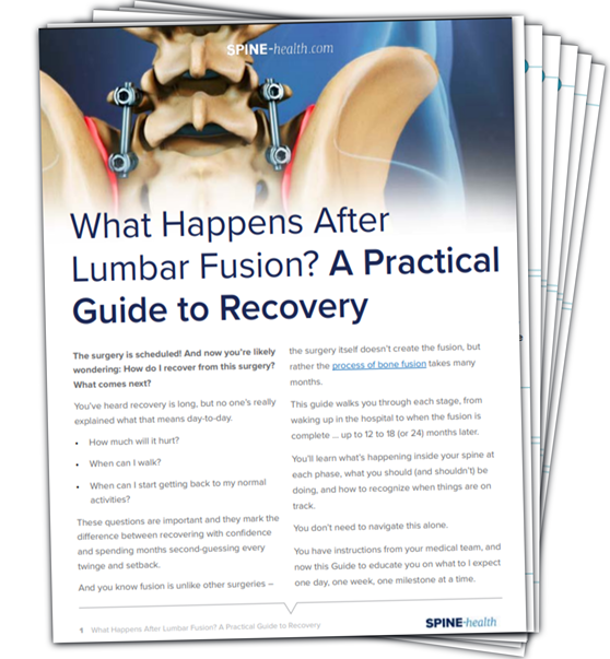 What Happens After Lumbar Fusion? Step-by-Step Recovery