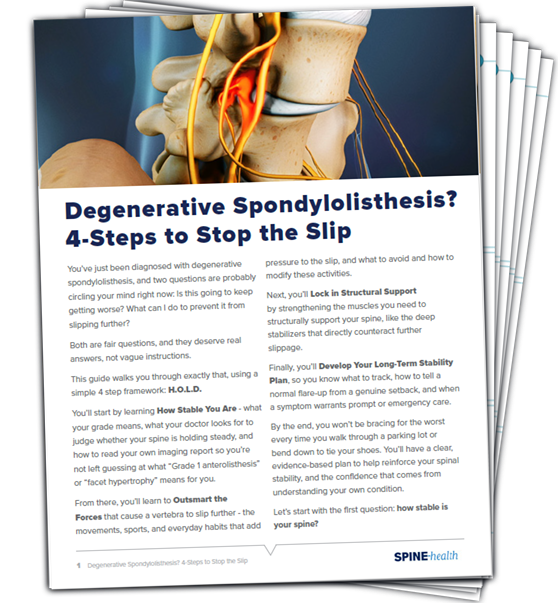 Degenerative Spondylolisthesis: 4-Steps to Stop the Slip